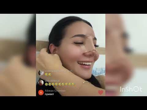 Видео: АЙГУЛ РИНОПЛАСТИКА. #айгулкослайк #ринопластика #гуджан 