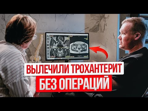 Видео: Простой и эффективный способ лечения ТРОХАНТЕРИТА. Избавит от боли в  БЕДРЕ за МЕСЯЦ