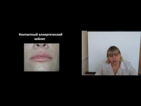 Видео: Хейлиты