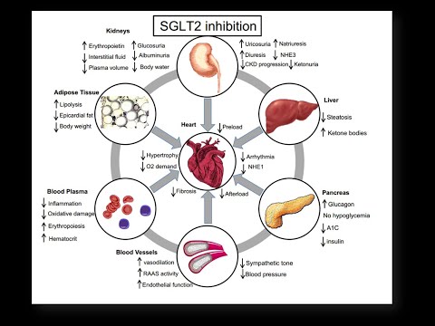 Видео: Перспективы применения ингибиторов SGLT-2 для коррекции нарушений ритма сердца