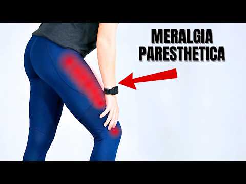 Видео: Лучшие советы по сну для страдающих парестетической мералгией!