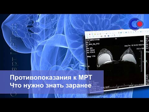 Видео: Противопоказания к МРТ. Что нужно знать заранее - 7 полезных фактов