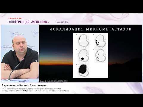 Видео: Нужна ли нам биопсия сторожевого лимфоузла в эру совр.адъювантной терапии меланомы? Барышников К.А.