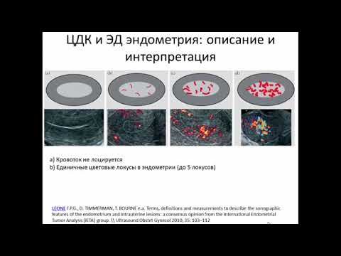 Видео: УЗИ патологии эндометрия.Видеолекция
