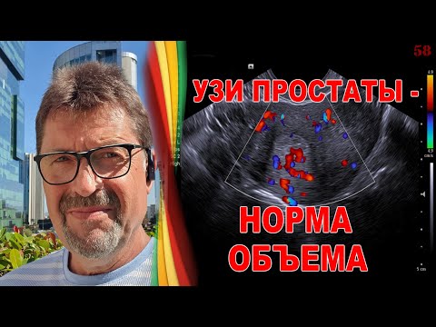 Видео: Простатит  - методы обследования. УЗИ простаты - норма объема. Как относиться к измерениям простаты.