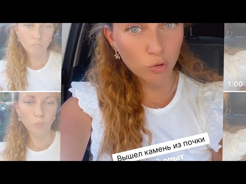 Видео: КАМЕНЬ В ПОЧКЕ ВЫШЕЛ, СРЕДСТВО ОТ КАМНЕЙ В ПОЧКАХ, ПРОВЕРЕНО 💯
