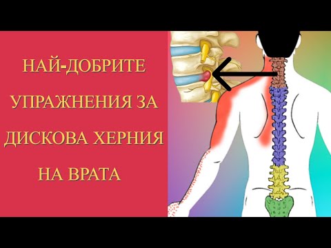 Видео: ДИСКОВА ХЕРНИЯ НА ВРАТА - От Къде е Изтръпването | Съвети От КИНЕЗИТЕРАПЕВТ | УПРАЖНЕНИЯ