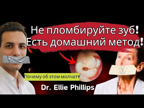 Видео: Восстановление кариеса и пломбирование поврежденных зубов дома | Методы, о которых вам не расскажут!