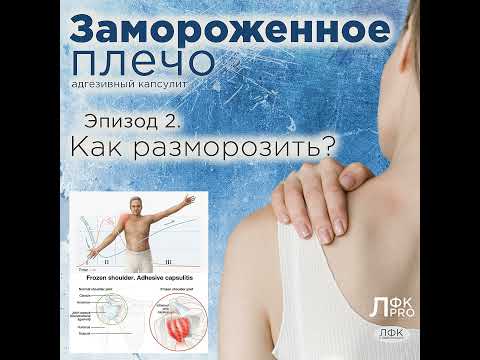Видео: Замороженное плечо. Эпизод 2. Как разморозить?