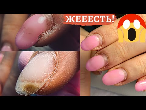 Видео: Что случилось с ногтями? 😱🙈