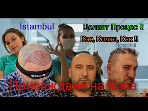 Видео: Присаждане на Коса !! Зъбни Импланти !!