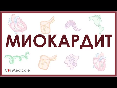 Видео: Миокардит