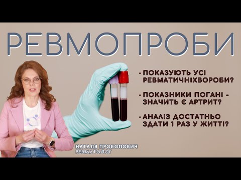 Видео: РЕВМОПРОБИ  стосується кожного // Міфи та популярні питання про аналіз