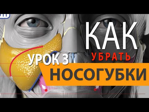 Видео: ✅ КАК УСТРАНИТЬ НОСОГУБКИ. Урок 3. Миллион нюансов. КАК ПРАВИЛЬНО и БЕЗОПАСНО