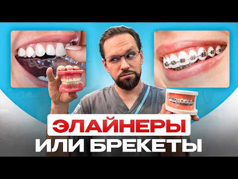 Видео: Элайнеры или брекеты? Посмотрите это видео ПЕРЕД ВЫБОРОМ