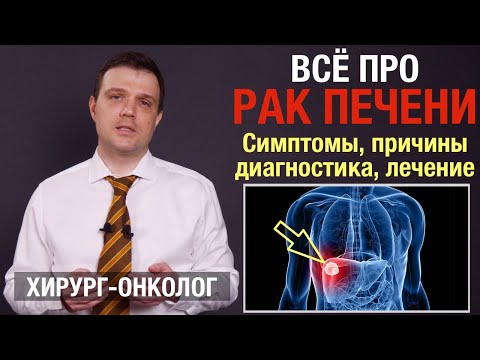 Видео: Рак печени. Симптомы, причины, лечение рака печени. Диагностика опухоли. Цирроз печени, гепатит