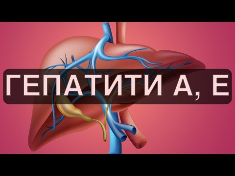 Видео: Вірусні гепатити. Гепатит А (хвороба Боткіна). Гепатит Е