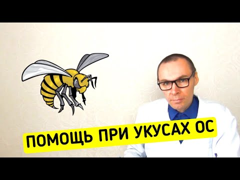 Видео: Первая помощь если УКУСИЛА ОСА