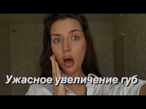 Видео: АСМР Болталка шёпотом. Моя ужасная история об увеличении губ😱