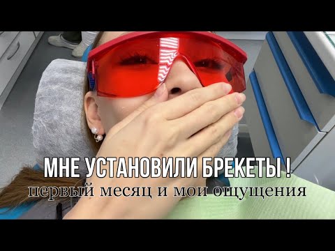 Видео: ПОСТАВИЛИ БРЕКЕТЫ// первые ощущения