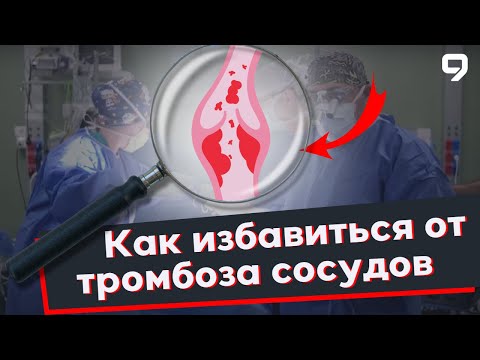 Видео: Программа "Дело врачей". Тромбоз сосудов. Закупорка венозных сосудах. Окклюзия аорты