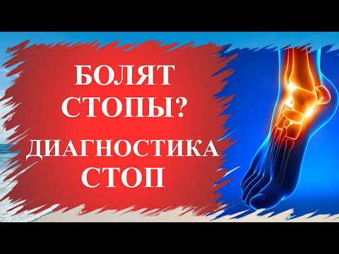 Видео: ✔Как определить состояние здоровья по стопам человека? / Методы лечения ног💥 #ноги #лфк