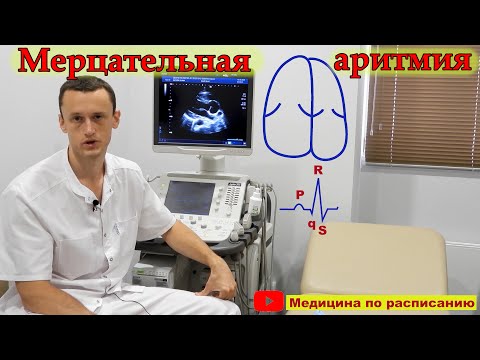Видео: Мерцательная аритмия, фибрилляция предсердий (её диагностика)