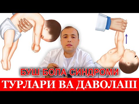 Видео: Буш бола синдромининг наслий шакллари ва уларни даволаш