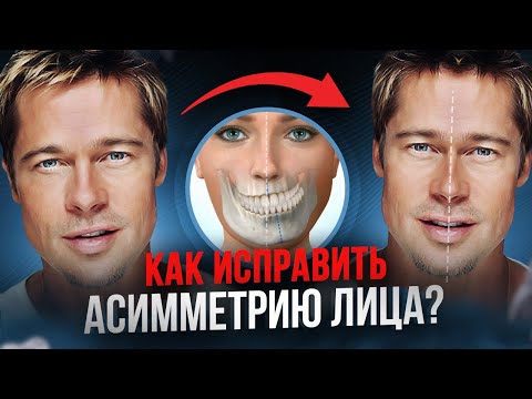 Видео: Асимметрия лица. Причины возникновения и нужно ли ее исправлять?