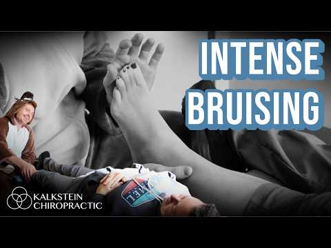 Видео: Невероятно быстрое восстановление после растяжения лодыжки! Секретная техника лечения от мануальн...