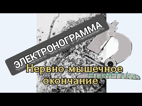 Видео: НЕРВНО-МЫШЕЧНОЕ ОКОНЧАНИЕ (электронограмма)