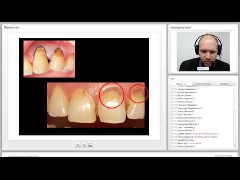 Видео: 2016 12 06  Методики наложения коффердама