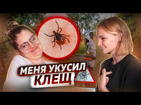 Видео: Меня укусил клещ | клещевой энцефалит