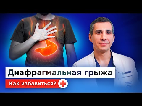 Видео: Как понять, что есть ГПОД? Грыжа пищеводного отверстия диафрагмы: причины, симптомы, лечение