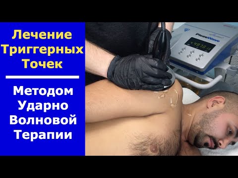 Видео: Лечение триггерных точек на УВТ. Процедура УВТ
