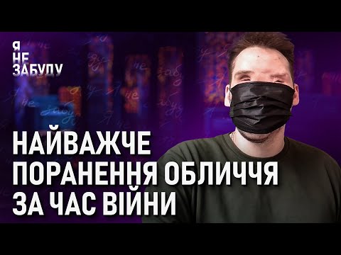 Видео: Найважче поранення обличчя за час війни | Я не забуду