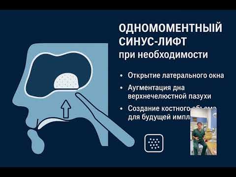 Видео: Чтобы подготовить челюсть к имплантации - зуб с кистами лучше сохранить!: #ПАЗА