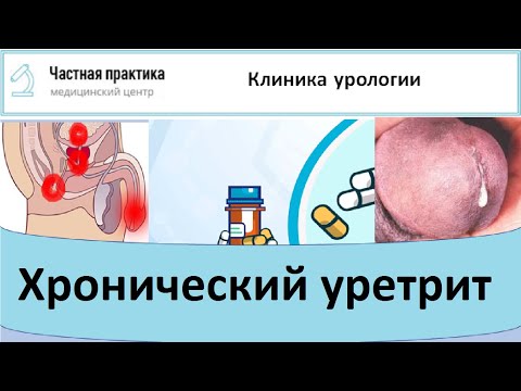 Видео: Хронический уретрит