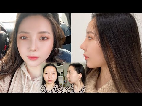 Видео: ZolbooTv-д тавтай морил. / 3. Гоо сайхны мэс засал. (Энхжин.)