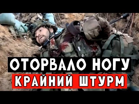 Видео: Оторвало ногу во время штурма.