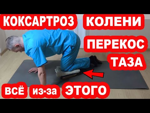Видео: КОКСАРТРОЗ, Перекос таза, Боль в Тазобедренных суставах и КОЛЕНЯХ. Всё из-за этих МЫШЦ. Как лечить?