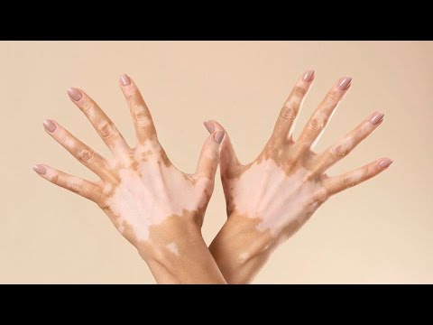 Видео: Любовь Гильфанова  в прямом эфире!