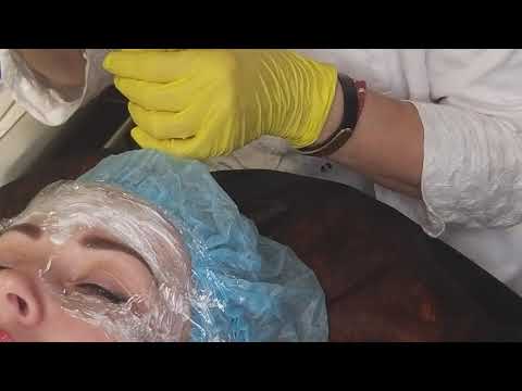 Видео: Мезоботокс(фрагмент)