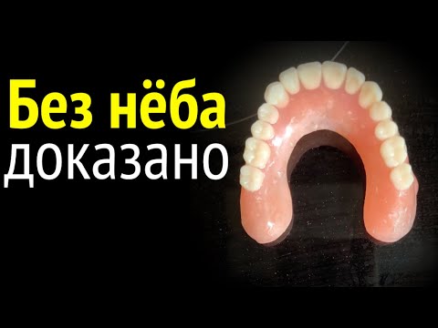 Видео: Реальные Комментарии. Ещё в 1989 году делали Съёмные БЕЗ нёба #безнёбасъёмныепротезы #съёмныепротезы