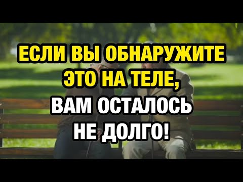 Видео: Если на теле пожилого человека вдруг появляется это, готовьтесь к худшему…