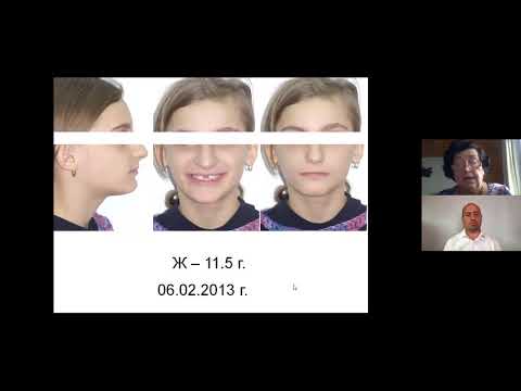 Видео: Последователи на дисциплината "Алекзандър" - епизод 5: д-р Иванка Обрешкова