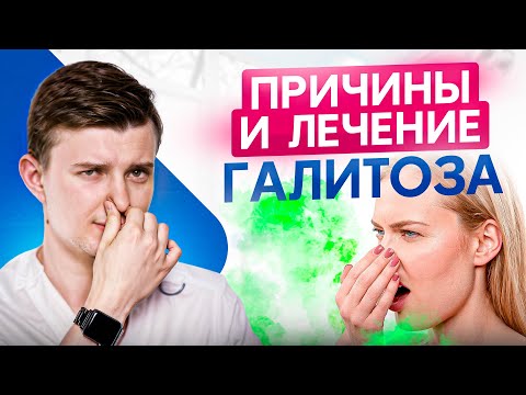 Видео: Вот почему появляется запах изо рта! Причины и лечение галитоза