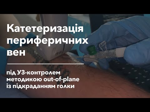 Видео: Катетеризація периферичних вен під УЗ-контролем | US-Guided Peripheral IV Access
