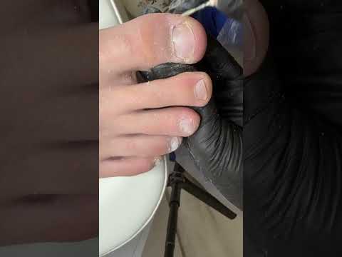 Видео: Нужен ли молодым мужчинам педикюр? Часть 2