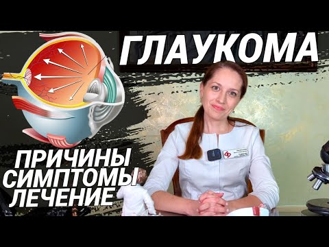 Видео: ГЛАУКОМА: как не ослепнуть? Что делать при давлении в глазах? Симптомы, причины, лечение глаукомы!